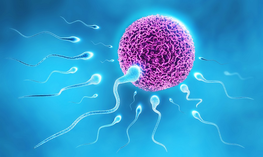 آزواسپرمی (Azoospermia)