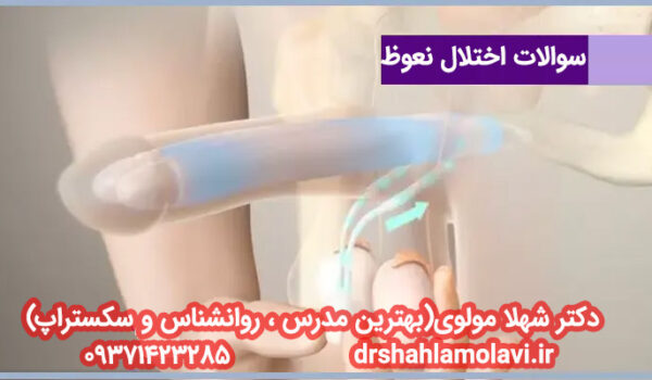 سوالات اختلال نعوظ