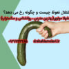 اختلال نعوظ